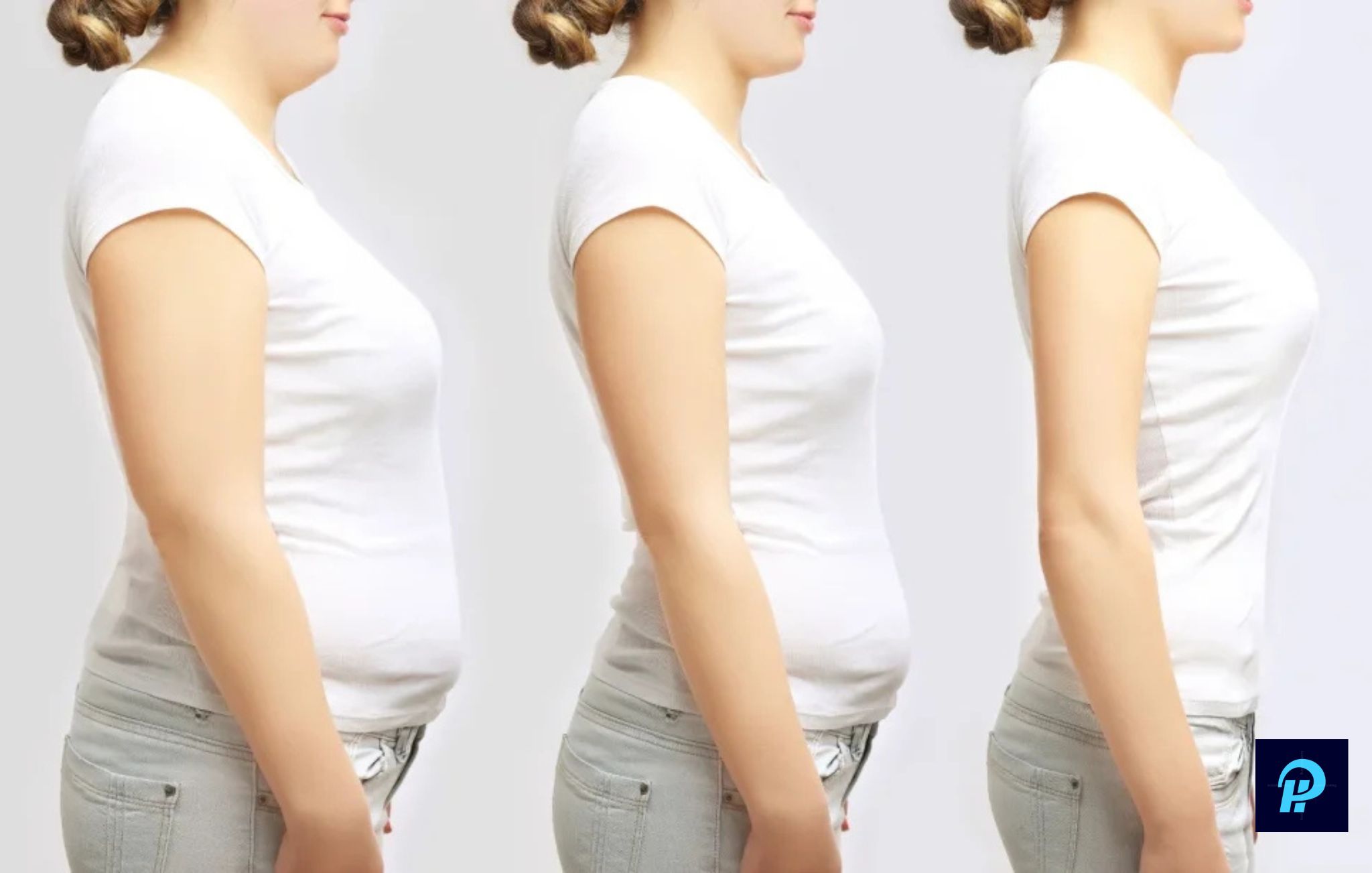 Understanding Apron Belly vs FUPA After Weight Loss or Pregnancy